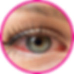 Conjunctivitis eye hospital in nashik